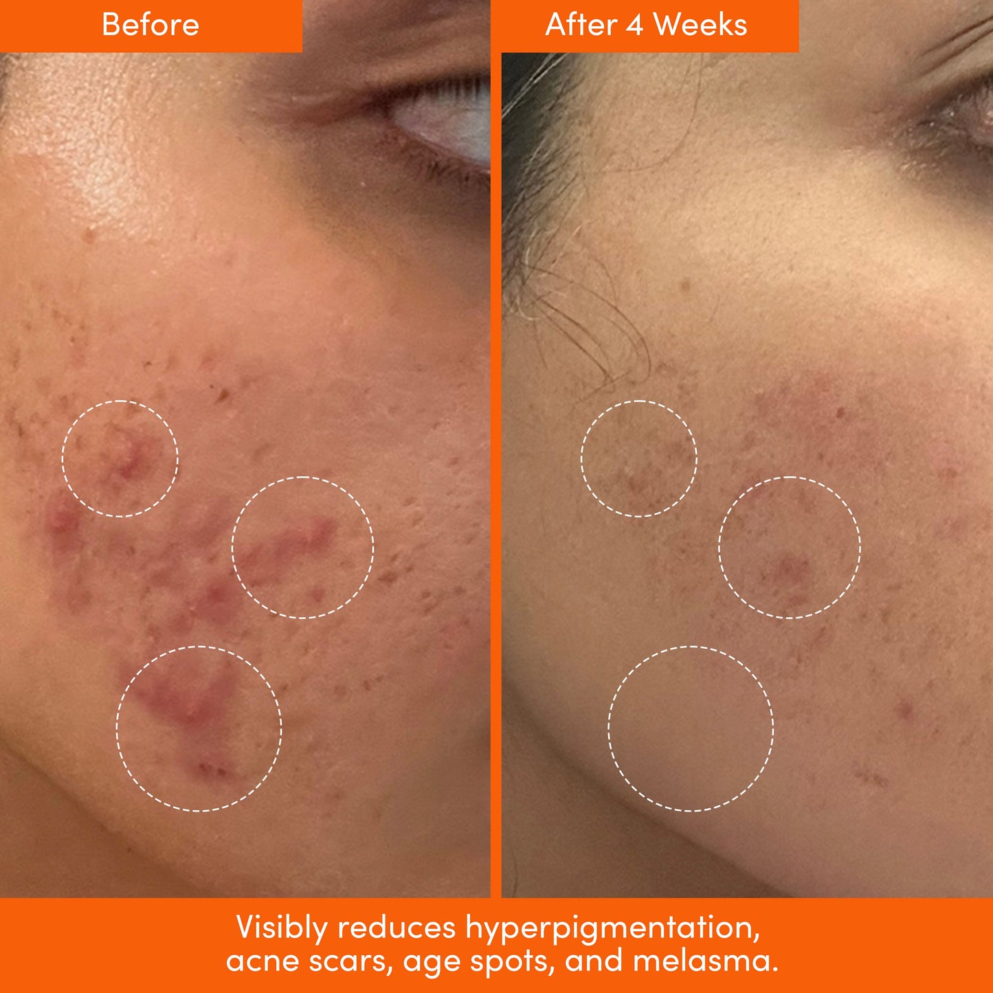 The Placenta Facial Dark Spot Serum + Barrier Repair Cream Bundle