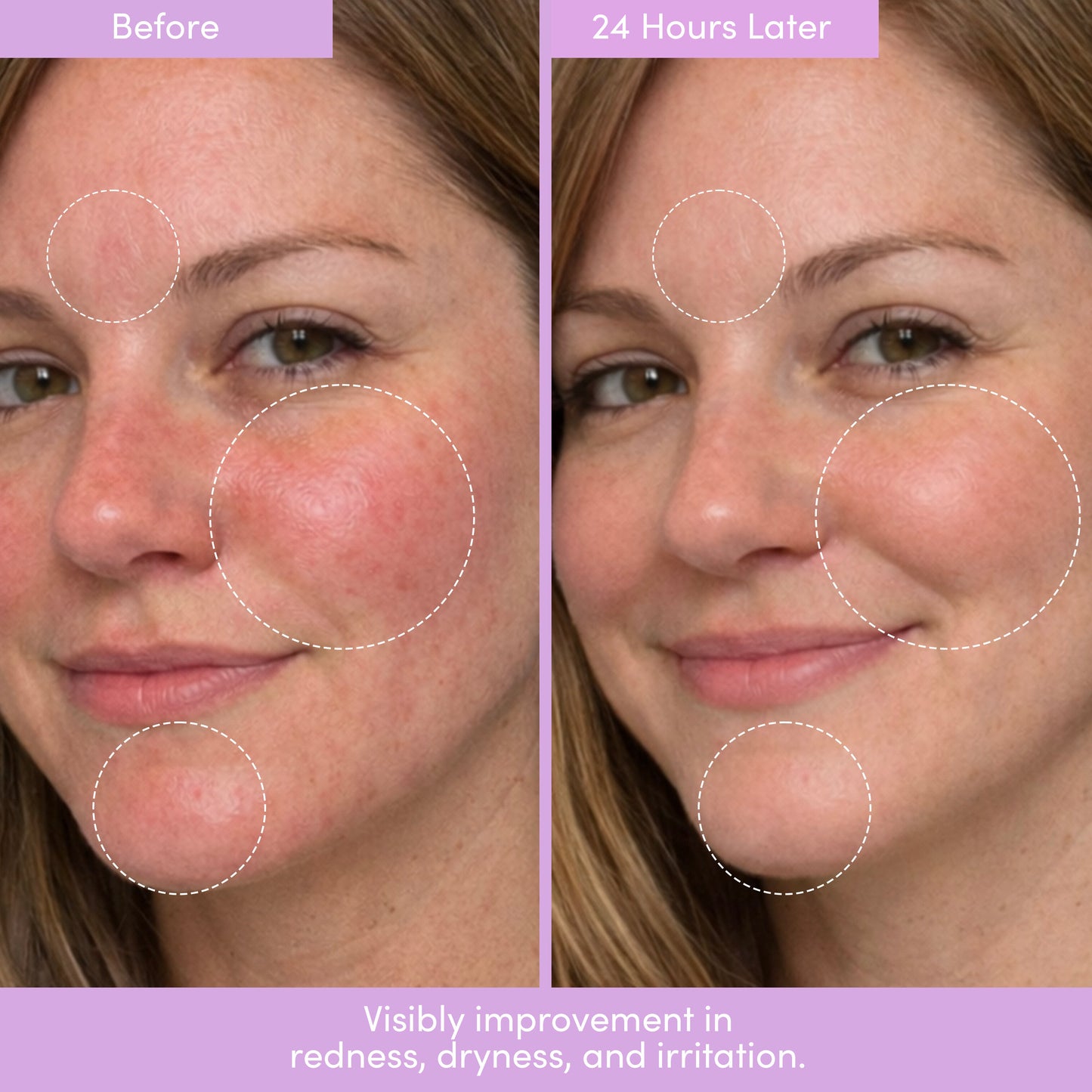 The Placenta Facial Dark Spot Serum + Barrier Repair Cream Bundle